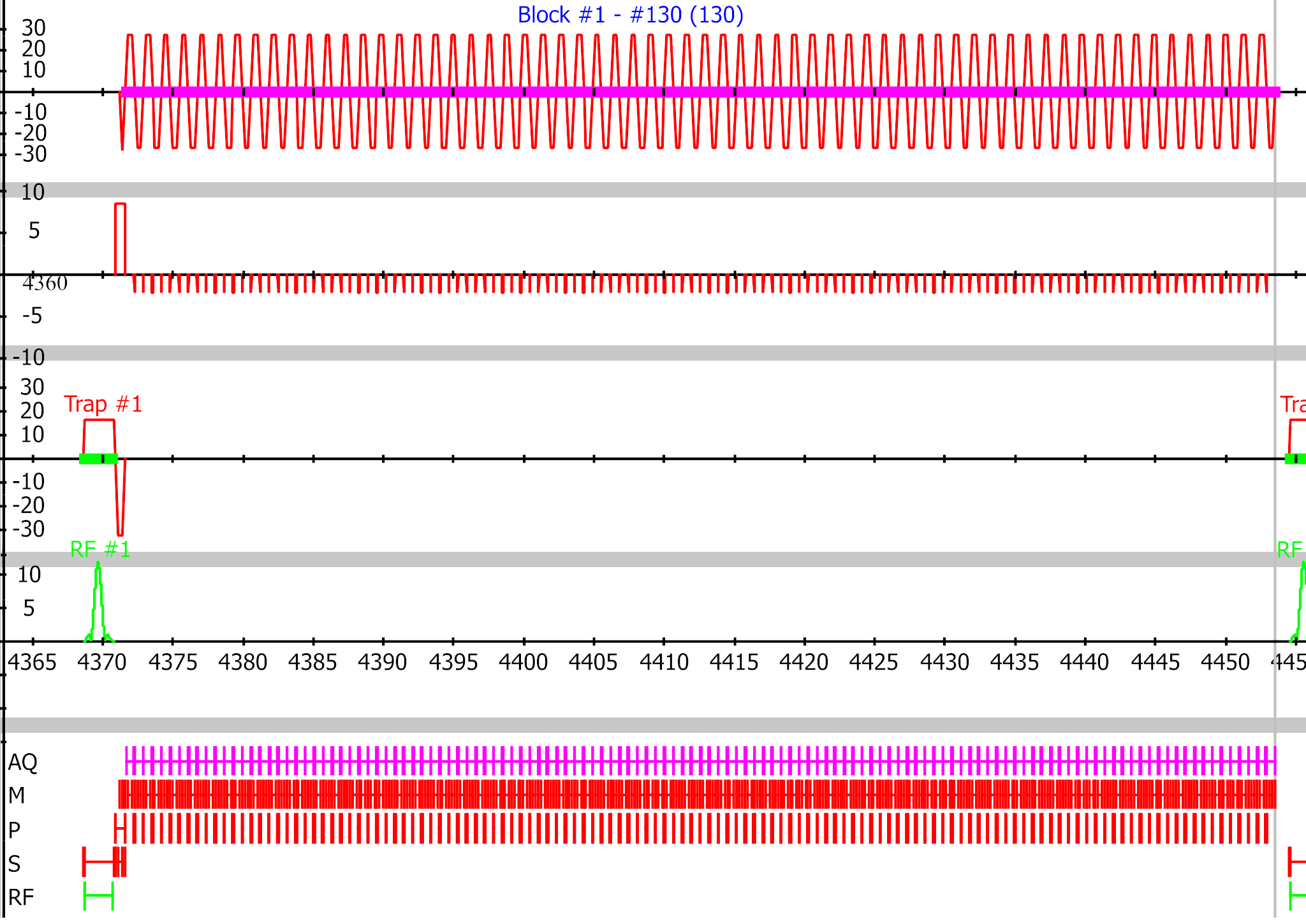 EPI pulse sequence diagram