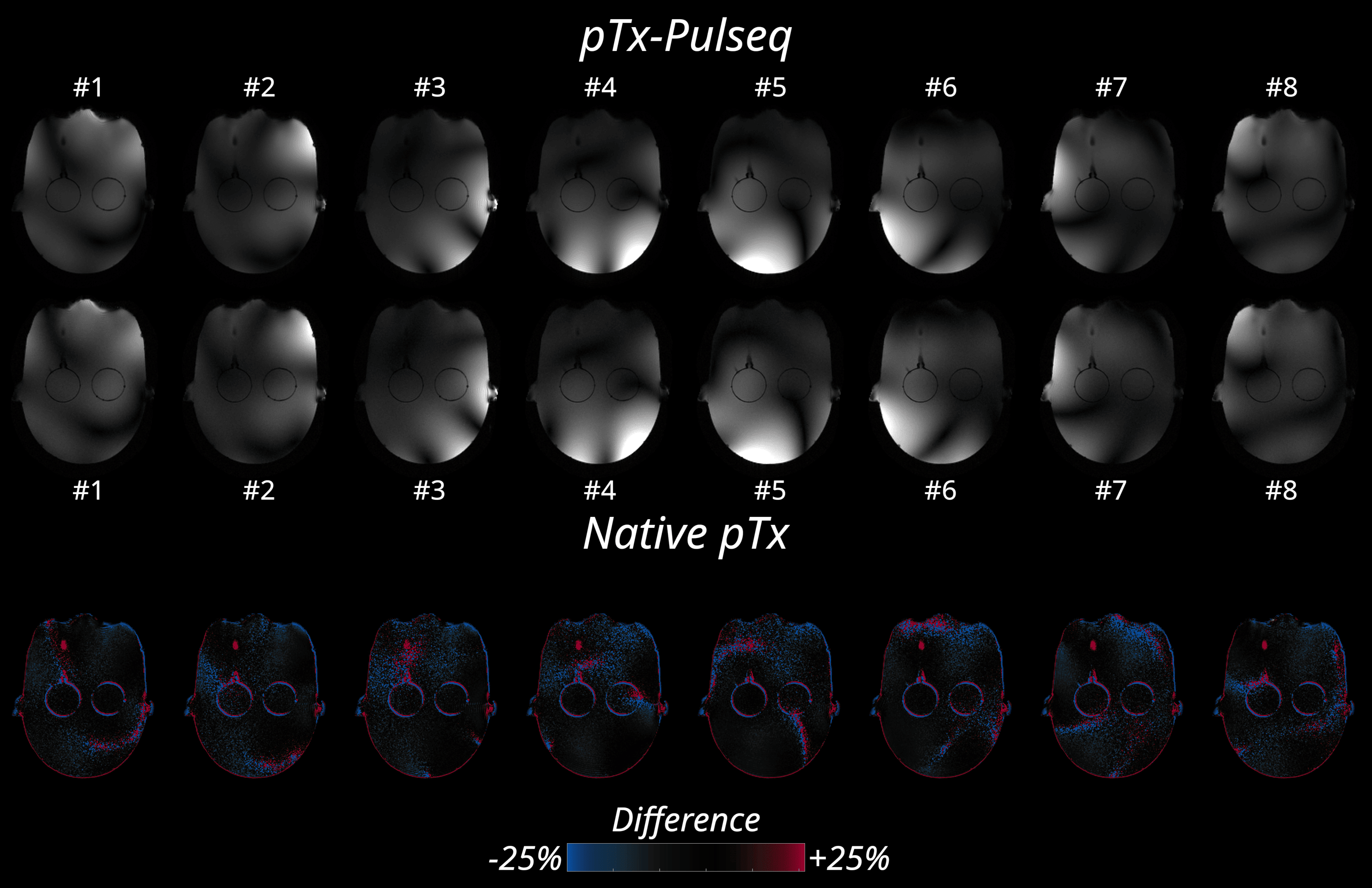 GRE slices each acquired with 1 Tx channel